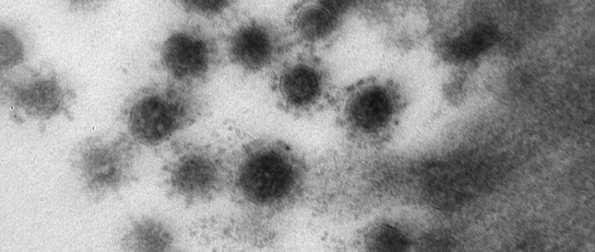Японские ученые прогнозируют скорую самоликвидацию дельта-штамма COVID-19 